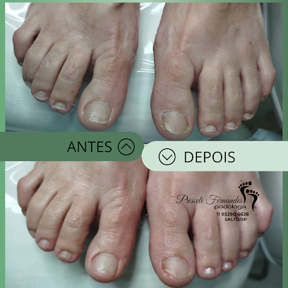 Prisceli Fernandes Podóloga